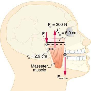 <b>Figure 9.43</b> A person clenching a bullet between his teeth.